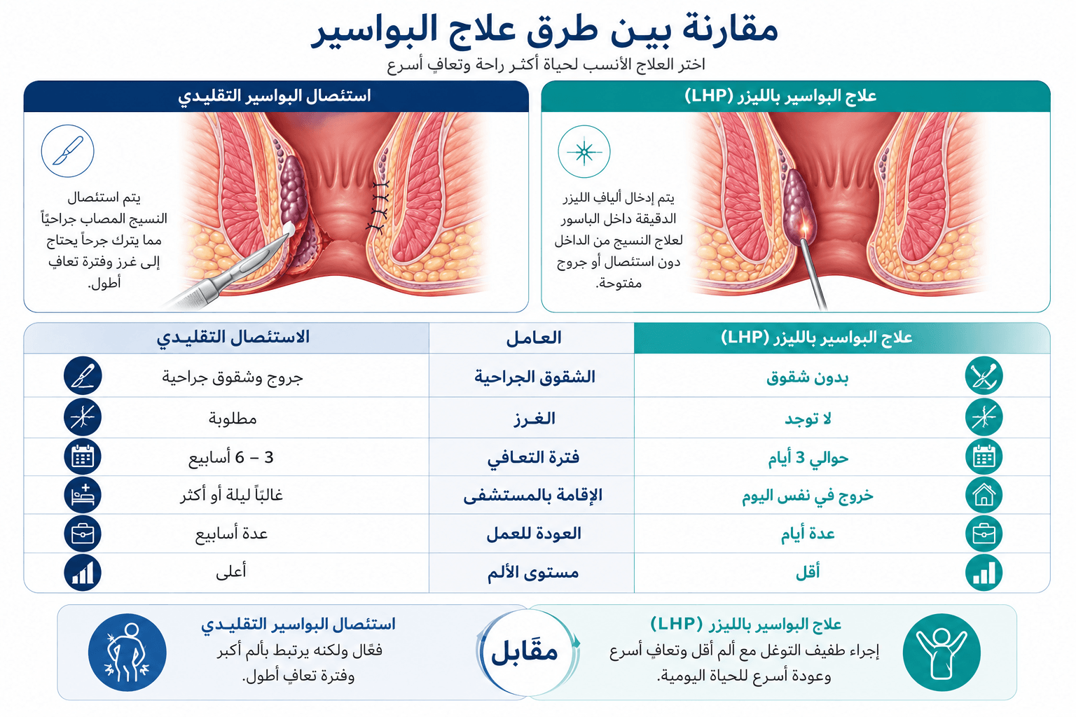 مقارنة بين الجراحة التقليدية للبواسير وعلاج البواسير بالليزر (LHP) من حيث فترة التعافي والألم والغرز والإقامة بالمستشفى والعودة إلى النشاط اليومي.